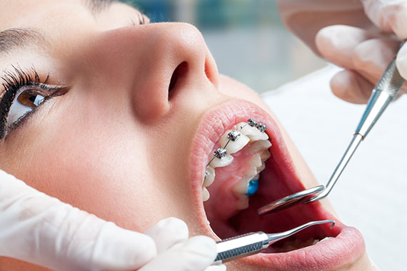 Odontologia-estetica-em-curitiba-CEOPAR-tratamentos2