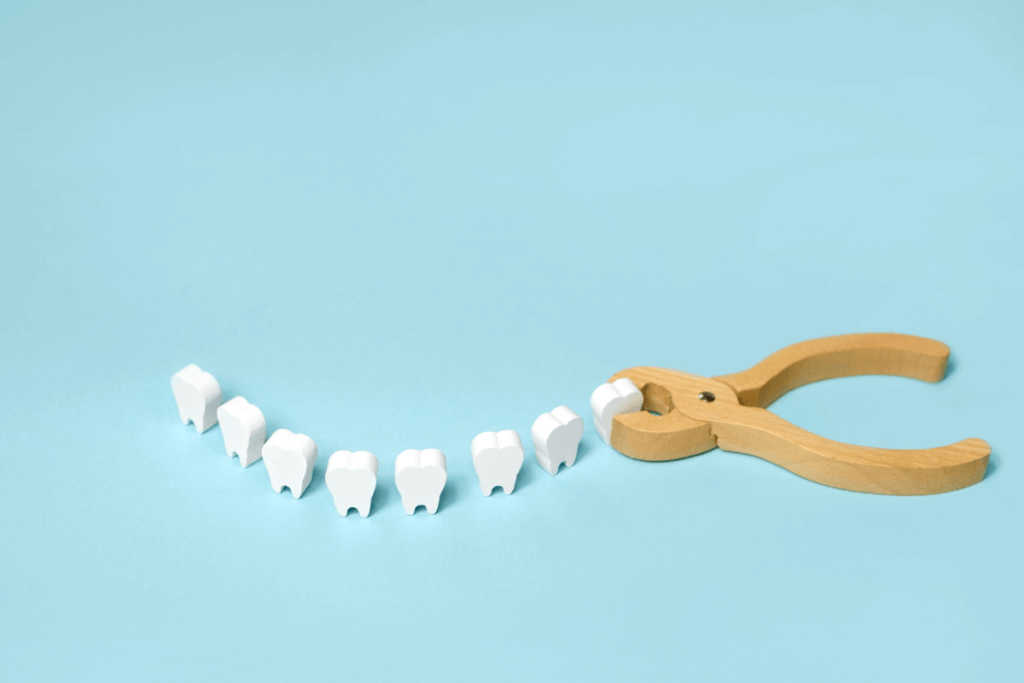  5 dicas para você saber antes de EXTRAIR O dente do siso