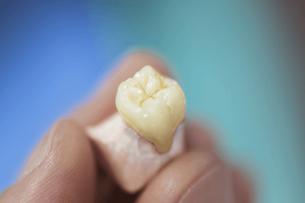 Entenda qual a prótese dentária mais indicada para cada caso! 