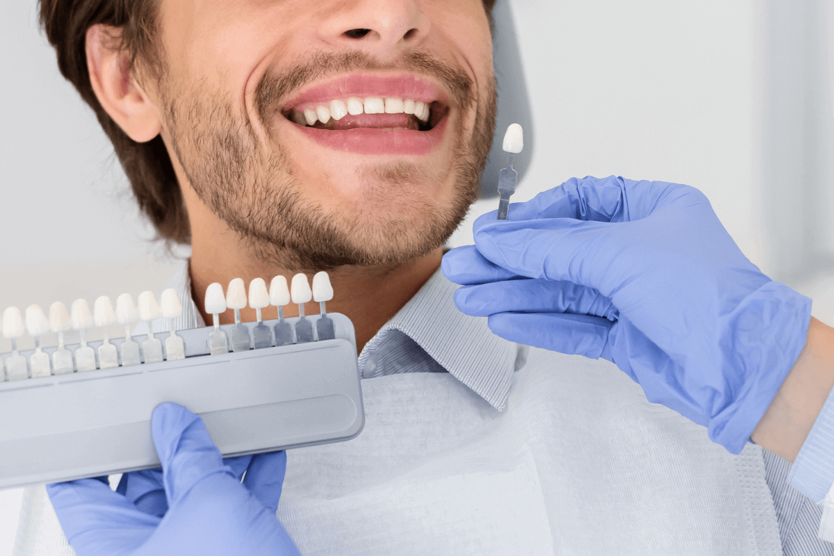 Clareamento de dente: Quais são os tipos que existem e como escolher