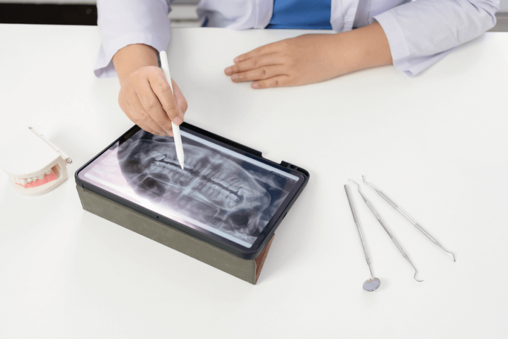 Perda óssea dentária tem cura? Entenda o que pode ser feito