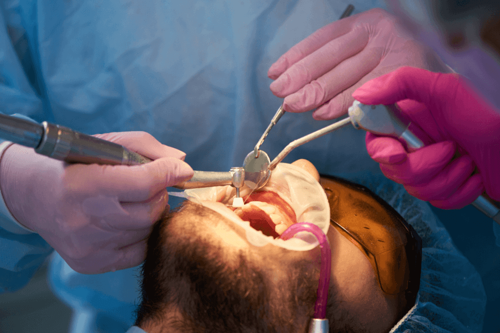 Cirurgia de Enxerto Ósseo Dentário: Entenda Como Funciona o Procedimento e Por Que é Recomendado